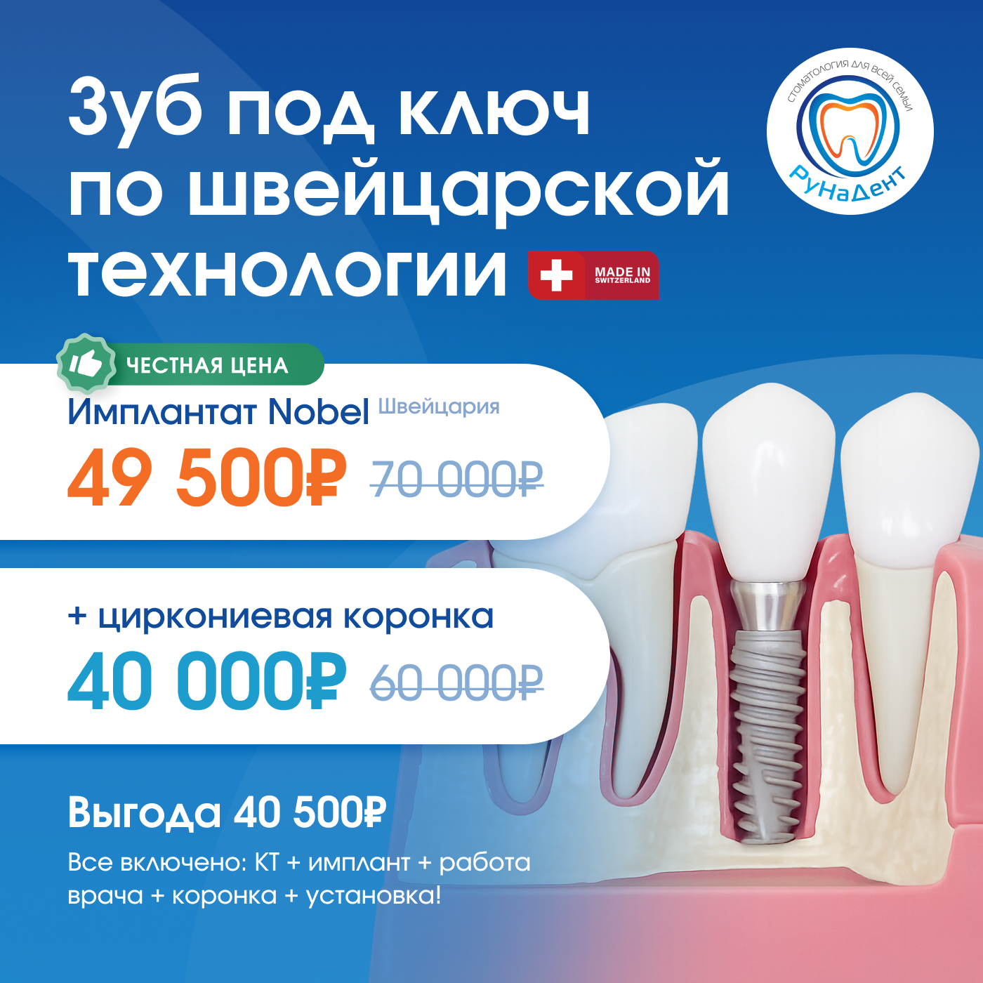Имплантация по честной цене